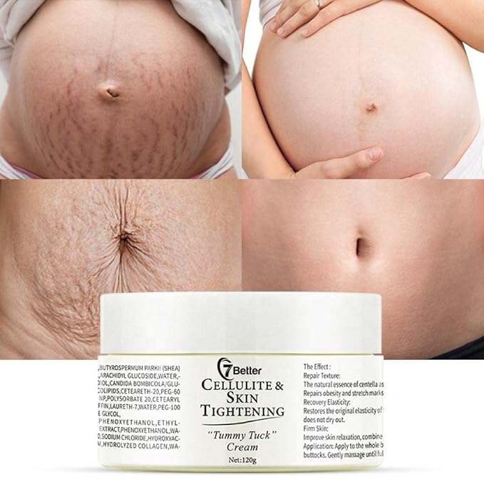 Stretch Marks and Scars Removal Cream for Pregnancy - Scars Repair, Abdominal Firming, and Gentle Stretch Marks Eradication Skincare Body-Velvo Beauty