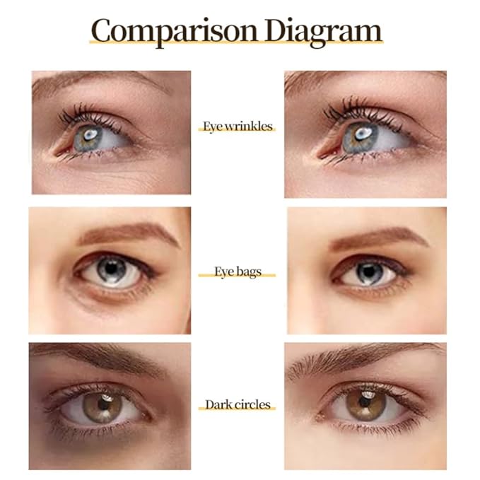 Generic 24 K Gold Eye Mask Puffy Eyes and Dark Circles Treatment Relieve Pressure and Reduce Wrinkles, Revitalize and Refresh Your Skin-Velvo Beauty