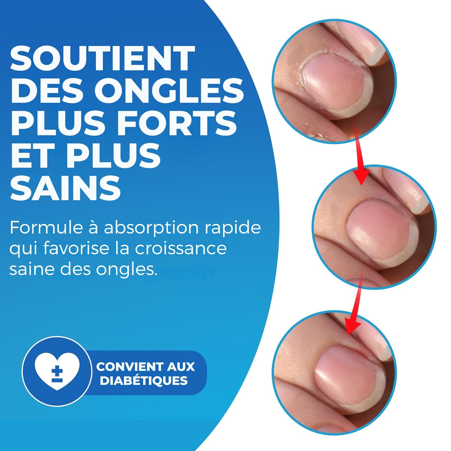 Imperial Feet Cuticle Oil for Nail Growth and Strength 30ml/1 FL Oz-Almond, Jojoba, Vitamin E Oil for Nails and Cuticles-Hydrates, Natural Nail Strengthener and Nourishes Dry Cuticles-Cuticle Softener-Velvo Beauty