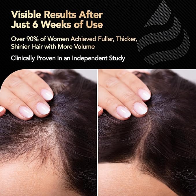 Hair Growth Vitamins for Women with Biotin, Collagen Peptides, Vitamin C & Omega-3 – 90 Capsules – Hair Supplements for Menopause & Postpartum – Hormonal Balance Support & Thicker Hair for Women-Velvo Beauty