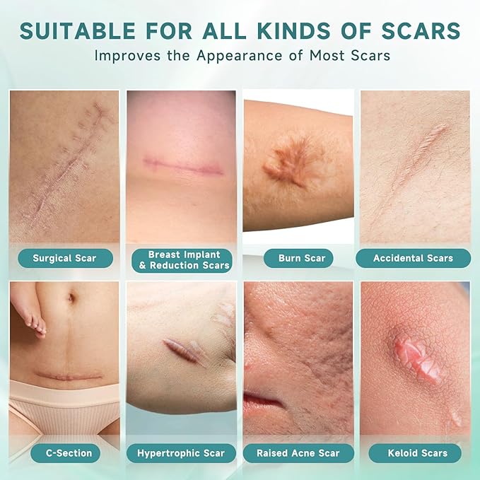 Scar Suite Bundle, Advanced Silicone Scar Cream and Scar Sheets, Advanced Scar Treatment for Surgery, Burns, and Injuries, Professional Grade Results-Velvo Beauty