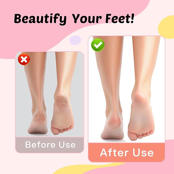 Electric Foot Callus Remover & Nail File - Electric Callus Remover for Feet, 9 Adjustable Speeds, 1800mAh Rechargeable, Portable Aluminum Body w/Type-C Charging for Home & Travel (Black)-Velvo Beauty