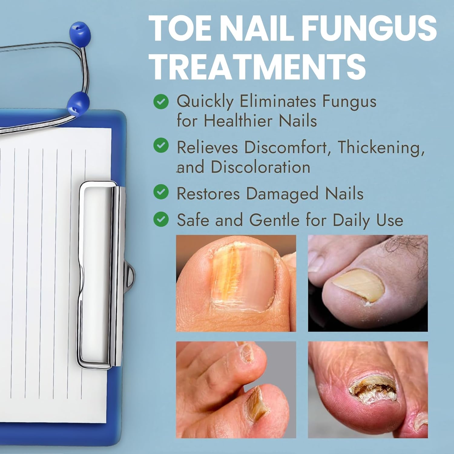 Nail Fungus Treatment Extra Strength for Toenail & Fingernails | Antifungal Nail Treatment with Tea Tree Oil | Fast-Acting, No-Touch Applicator | Restores Thickness & Discoloration | 20g-Velvo Beauty