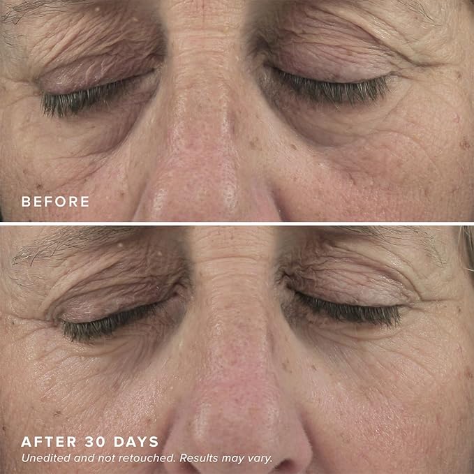 DRMTLGY Brightening Eye Masks (30 Pairs) - Caffeine Eye Masks for Dark Circles and Puffiness with Hyaluronic Acid, Eye Patches for Puffy Eyes - 2 pack-Velvo Beauty