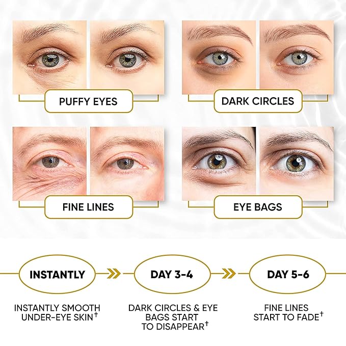Golden Under Eye Patches for Puffy Eyes & Eye Bags & Wrinkles, Under Eye Patches for Dark Circles,Collagen for Eye Bags, Under Eye Collagen Patches-Velvo Beauty