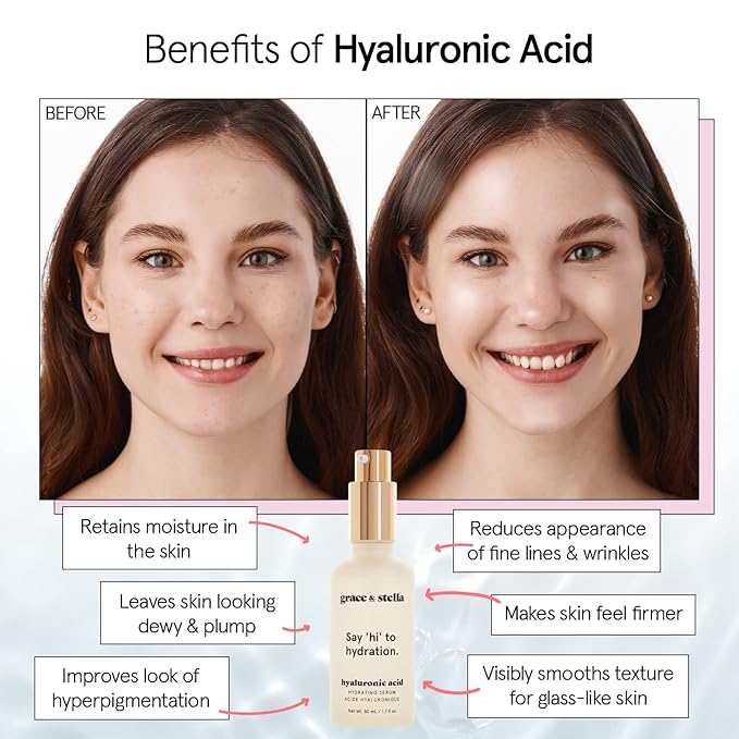 grace & stella Award Winning Hyaluronic Acid Serum (50ml/1.7 fl oz) Hydrating Hyaluronic Acid Serum for Face - Acido Hialuronico for Women - Remove Fine Lines, Wrinkles, Anti Aging - Vegan Skincare-Velvo Beauty