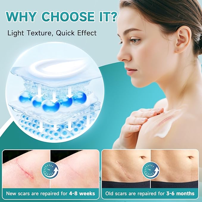 Advanced Scar Cream, Silicone Gel for Scars, Professional Scar Removal Cream for Surgical Scars, Stretch Marks, Old and New Scars 1.7 oz(50ml)-Velvo Beauty