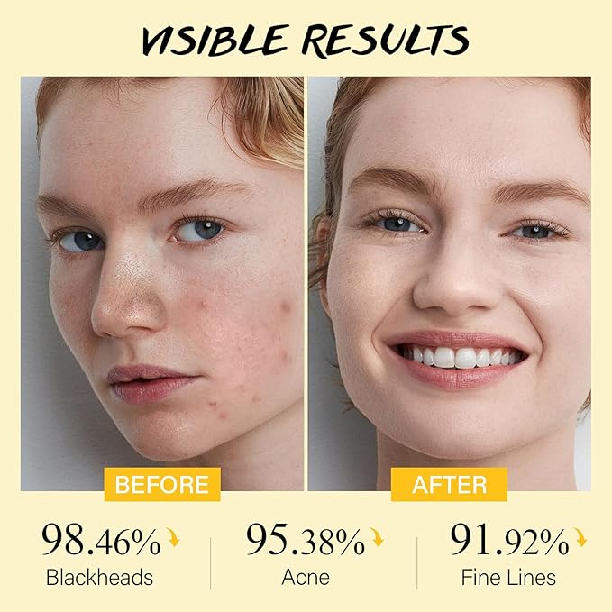 Lemon Face Scrub with Glycolic Acid Microdermabrasion Facial Scrub AHA Exfoliating for Women Men Safe Vegan Improves Acne Blackheads Soft Soothing without Irritation-Velvo Beauty