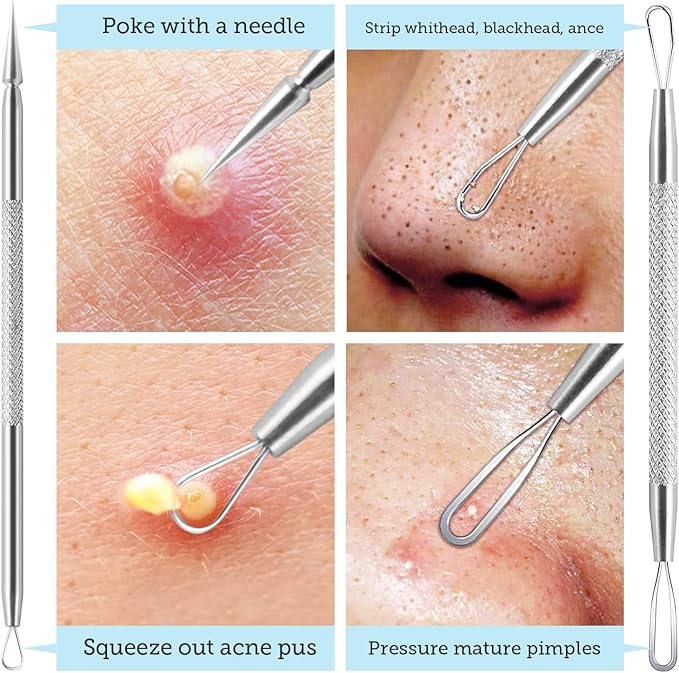 LitBear Pore Prep Tool, Blackhead Remover Pimple Popper Tool Kit, Stainless Steel Blackhead Extractions Tool for Acne, Whitehead Popping, Blemish, Comedone, Black-Velvo Beauty