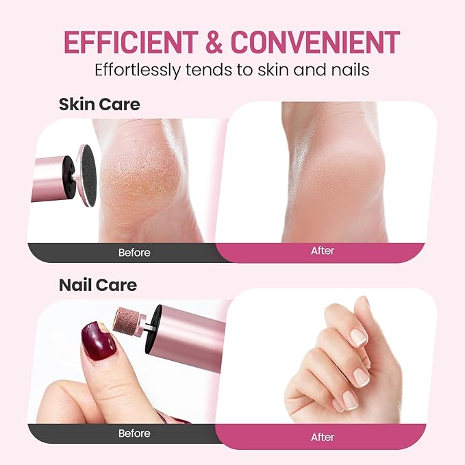 Electric Foot Callus Remover, 2 in 1 | 6 Speed Adjustable Foot File Nail Grinder with Sandpaper Disks, Professional Sander Pedicure Tool for Feet Dead Skin, Self Care Gifts for Women Mom Lover Friends-Velvo Beauty