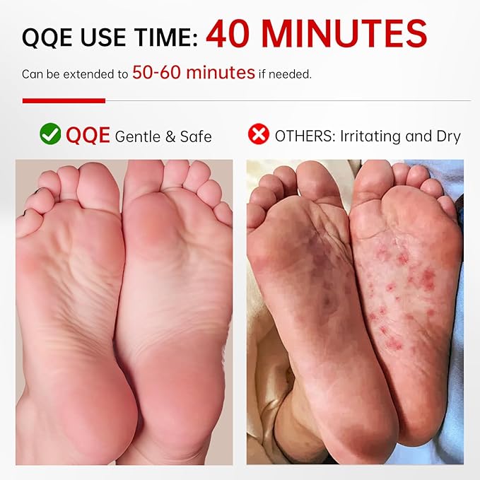 3 Pack Foot Peeling Mask, Hydrating Exfoliating Foot Mask for Dry Cracked Feet, Callus Remover & Cracked Heel Repair & Foot Care-Velvo Beauty