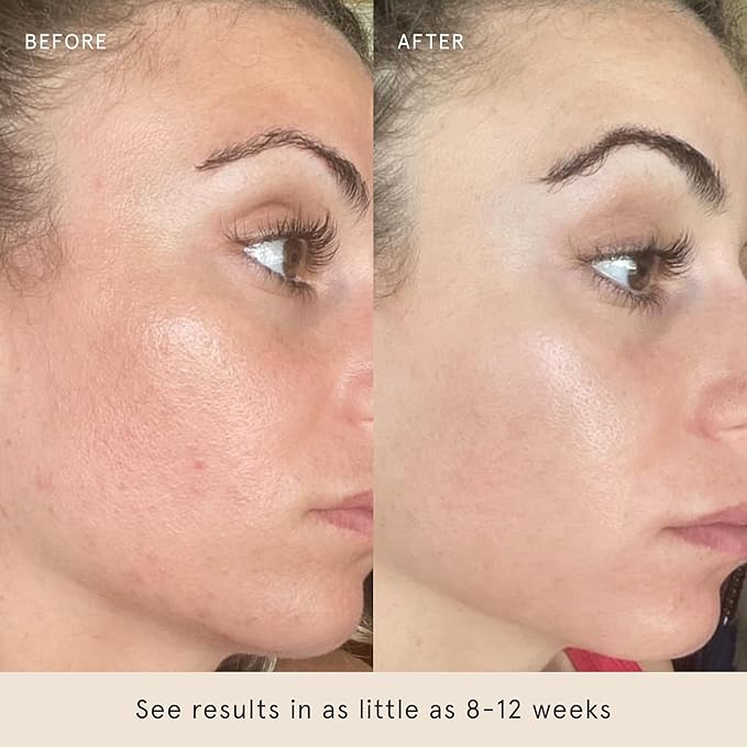 Barefaced Serum Duo - RetinAL & Liquid Gold to Hydrate, Even Skin Tone, & Reduce Signs of Aging-Velvo Beauty