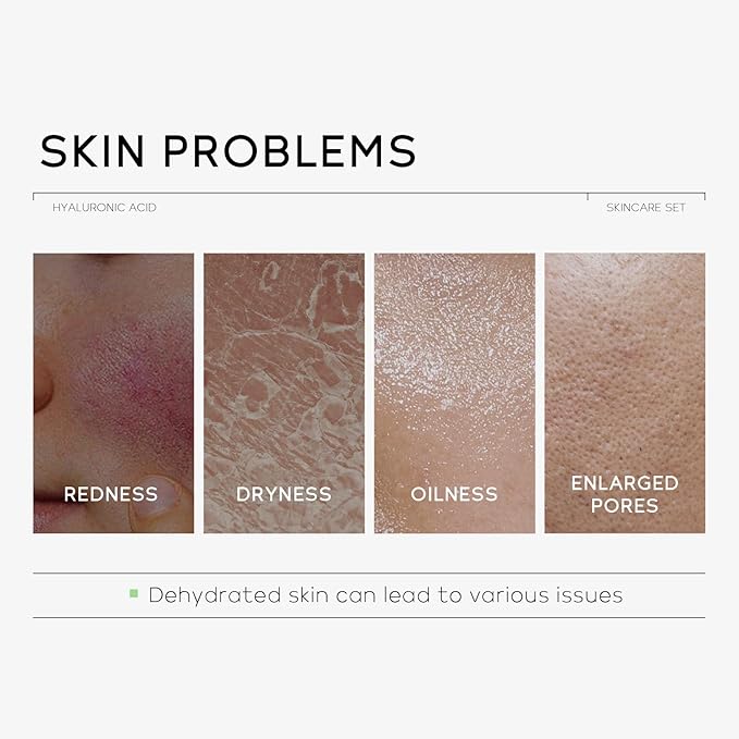 Hydrating Skin Care Set, Hyaluronic Acid Skin Care Kit with Serum for Face, Moisturizer, Travel Size Face Care Set for Women, Anti Aging Plumping Hydrating Firming for Dry Skin-Velvo Beauty