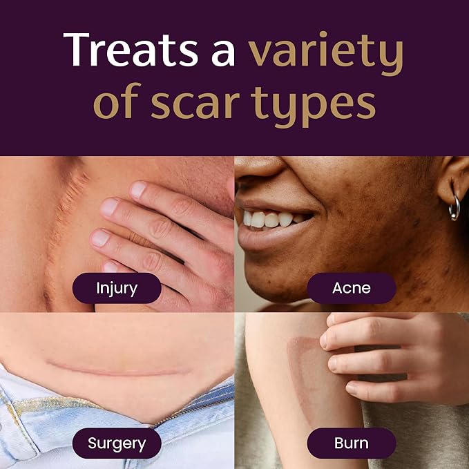 Mederma Scar Cream Plus SPF 30 - Advanced Scar Treatment, Protects from Sun Damage, Reduces Appearance of Scars from Acne, Burns, Surgery & Injury, 0.7 oz-Velvo Beauty