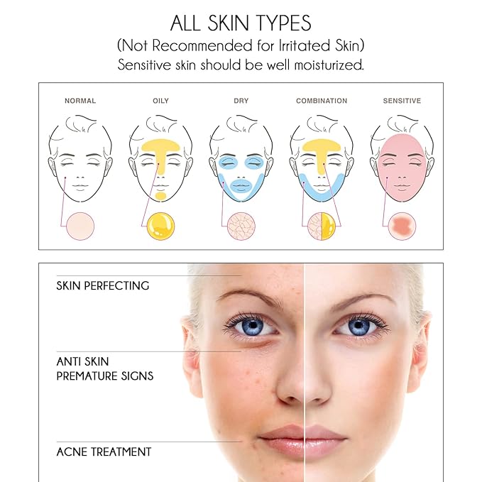 Pure Vitamin C Facial Serum with Salicylic Acid and Glycolic Acid, Anti-Wrinkle, Anti-Acne and Anti-Blackhead, Dark Spot Correcting, 7,5% AHA, Sebum Balance, ¾ oz-Velvo Beauty