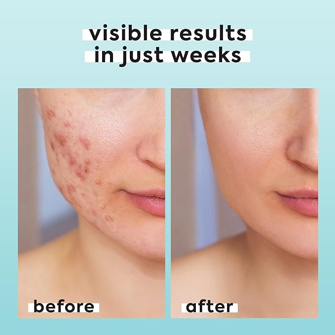 Hypochlorous Acid Spray for Face & Body - Helps Reduce Redness and Breakouts - Travel Size Hypochlorous Spray, Multi-Purpose Topical Facial Skin Repair, pH-Balancing Toner - TSA, Livaclean-Velvo Beauty