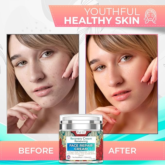 VAITE Face Moisturizer Remedy Skin Repair Cream with Snail, Salicylic Acid, Vitamin B5, Vitamin E, Collagen, and Ceramides for Men and Women Anti-aging Anti-wrinkle Made in USA Night and Day-Velvo Beauty