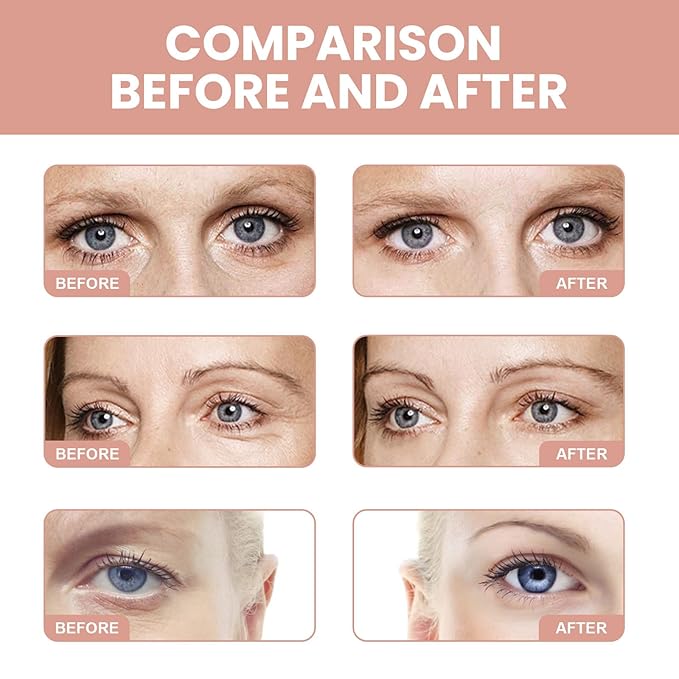 Retinol Eye Stick, Retinol Eye Cream for Dark Circles and Puffiness, Under Eye Cream Anti Aging, Retinol Eye Balm Reduce Fine Lines and Dark Circles, Visible Results in 3-4 Weeks-Velvo Beauty