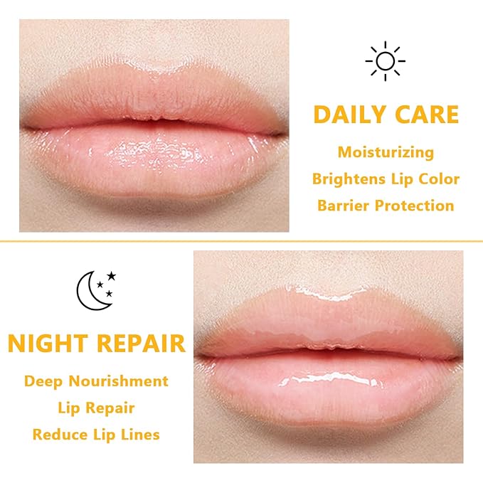 5 PCS Bee Balm Lip Balm Lip Mask Honey Pot, Lip Mask Propolis Moisturizing Lip Balm, Hydrating Prevention Dry and Cracked Lip Scrubs Exfoliator Lip Care (Strawberry&Watermelon&Honey&Apple Lime&Cherry)-Velvo Beauty