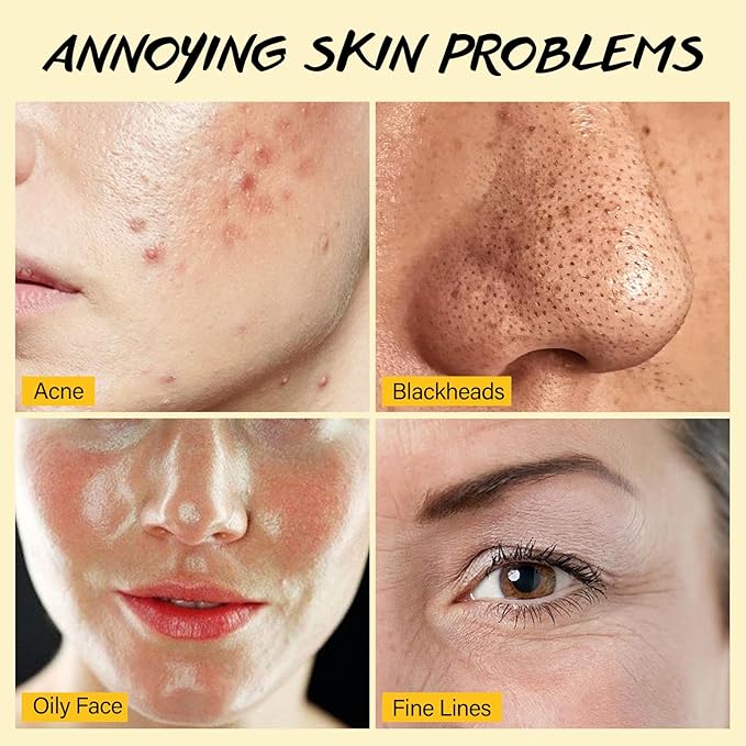 Lemon Face Scrub with Glycolic Acid Microdermabrasion Facial Scrub AHA Exfoliating for Women Men Safe Vegan Improves Acne Blackheads Soft Soothing without Irritation-Velvo Beauty