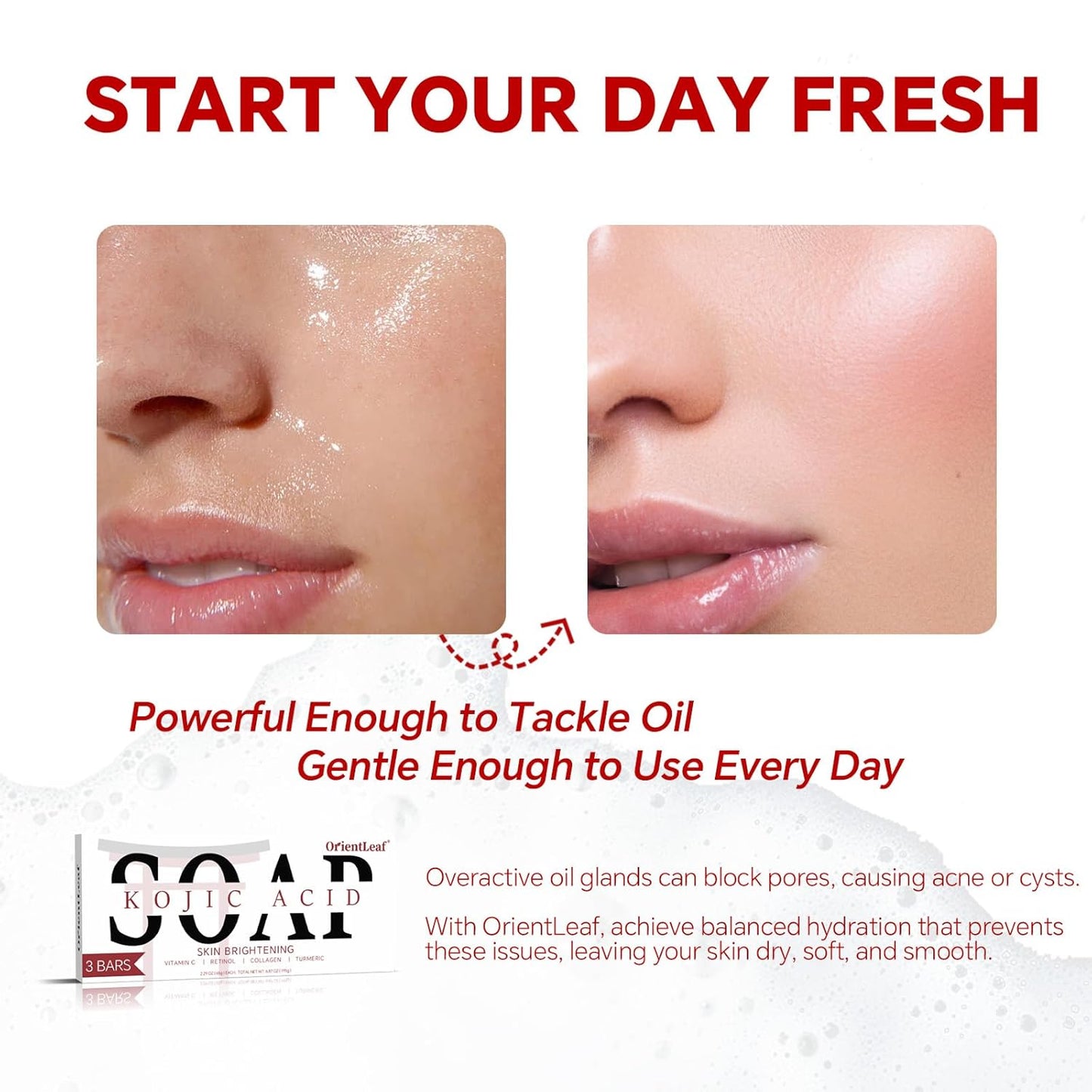 Kojic Acid Soap, Turmeric Soap Bar for Dark Spots, Fresh Citurs Scent, Gentle for Face and Body Wash with Vitamin C, Shea Butter, Retinol, Olive Oil, Collagen (3 PACK)-Velvo Beauty