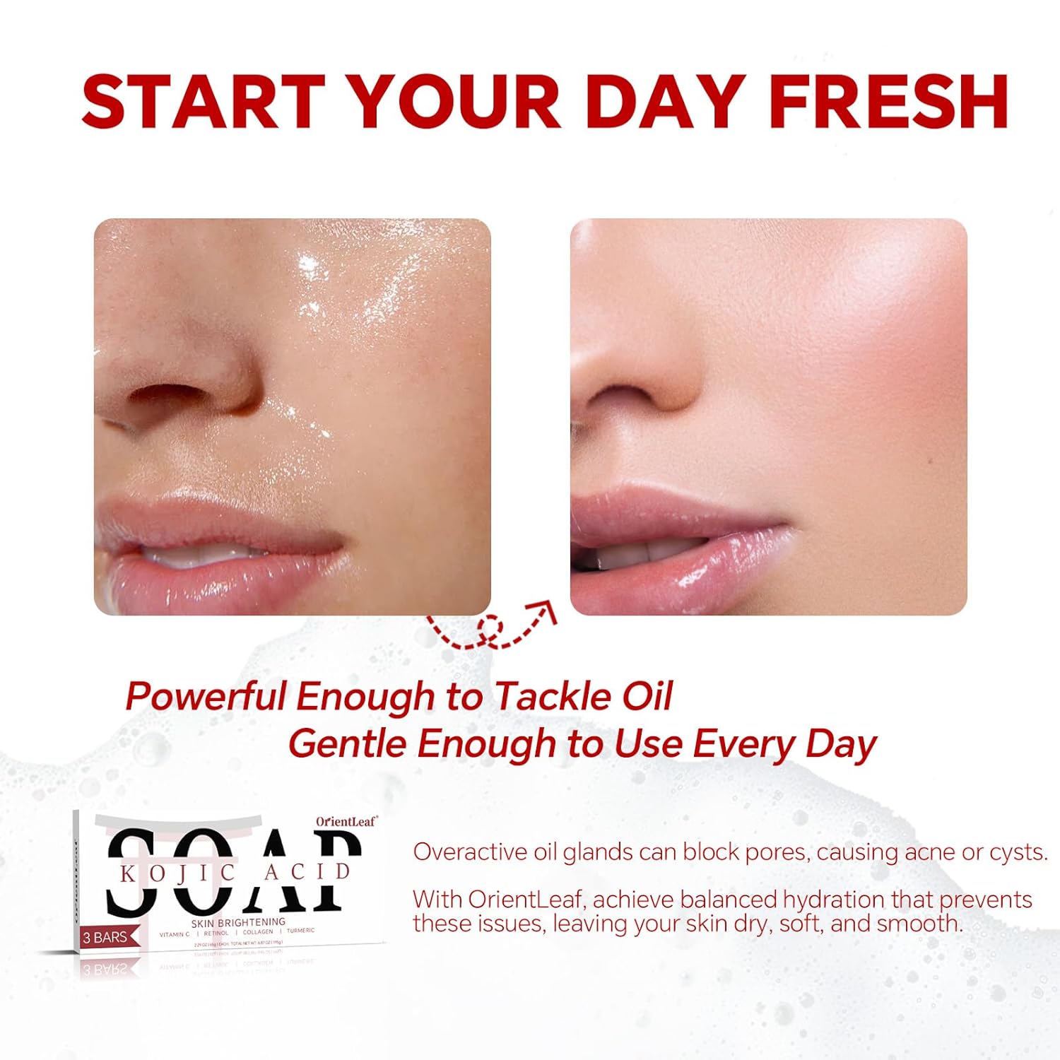 Kojic Acid Soap, Turmeric Soap Bar for Dark Spots, Fresh Citurs Scent, Gentle for Face and Body Wash with Vitamin C, Shea Butter, Retinol, Olive Oil, Collagen (3 PACK)-Velvo Beauty