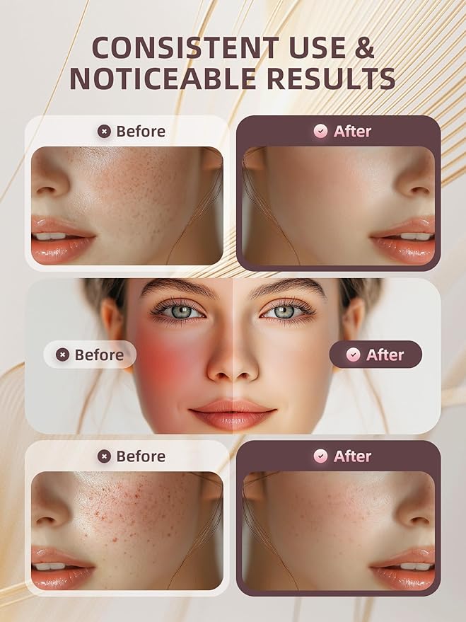 Facial Massager Tool, Beauty Device for Face and Full Body, Portable Face Lift Device for Skin Care, Against Dullness, Neck Massager for Women-Velvo Beauty