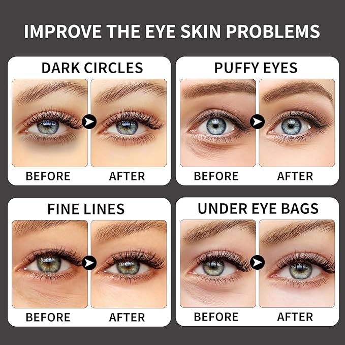 ROUSE 40 Pairs - Caffeine Under Eye Patches Eye Treatment Mask for Dark Circles Eye Fatigue Puffiness Refreshing Revitalizing Skin Care Eye Gel Pads (2 Boxes)-Velvo Beauty