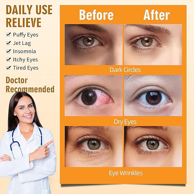 Serfeymi 16 Packs Steam Eye Mask for Sleeping, Self Heating Warm Eye Mask Skincare Disposable Eye SPA Heated Eye Mask for Dry Eyes Dark Circles Tired Eyes, Gifts for Mother's Day(Chamomile)-Velvo Beauty