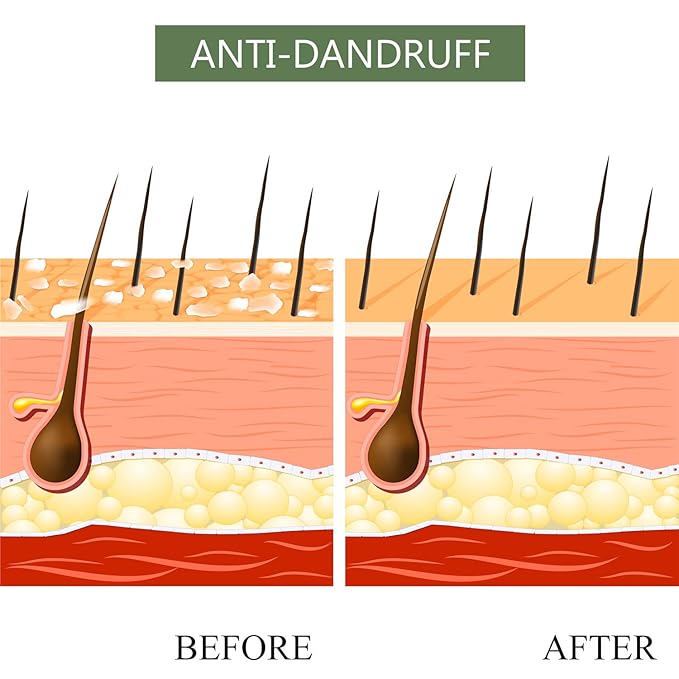 Luseta Tea Tree & Argan Oil Detangling Shampoo & Conditioner Set, 2 x 33.8 Oz-Velvo Beauty
