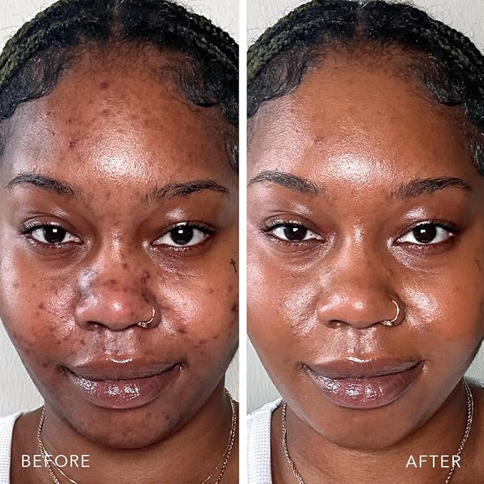 Doll 10 TCE Liquid Filter – CC Cream - Liquid Foundation - Lightweight Tinted Moisturizer & Skin Tint - Blurs Pores & Fine Lines - Vegan - Clean Makeup - [Tan/Deep] - 30 Day Supply-Velvo Beauty