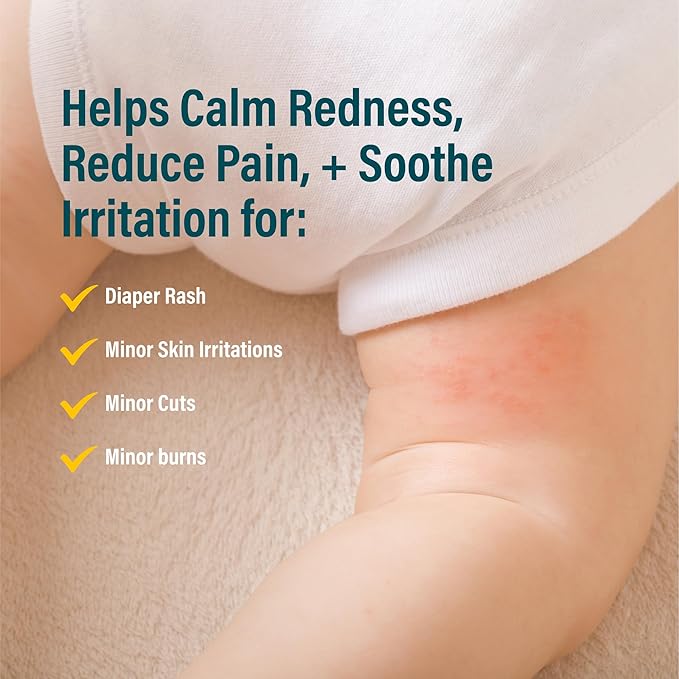 A+D Antimicrobial Hydrogel Spray – with Hypochlorous Acid, Removes Germs, Helps Heal Rashes & Irritations, Reduces Itch & Pain, Alcohol-Free, Non-Sting Formula, Safe for All Ages, 4oz-Velvo Beauty