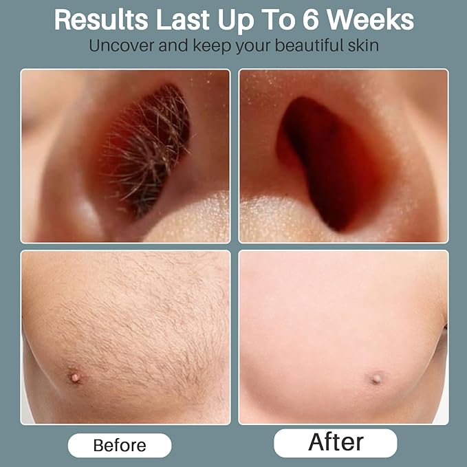 BLITZWAX Back and Nose Waxing Kit for Men, Hard Wax Warmer for Brazilian, Body and Face, At Home Hair Removal Kit, Beginner Friendly, Quick Heating, 93 Accessories, Blue Spruce-Velvo Beauty