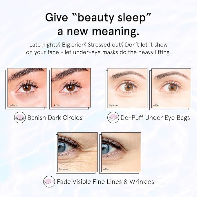 grace & stella Retinol Under Eye Patches for Puffy Eyes and Dark Circles - Restoring Gel Under Eye Masks with Hyaluronic Acid - Vegan Cruelty-Free Skincare - Birthday Gifts for Women (Purple, 6 Pairs)-Velvo Beauty