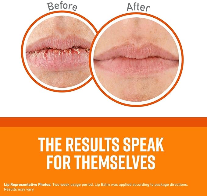 O'Keeffe's Unscented Lip Repair Lip Balm for Dry, Cracked Lips, Stick, (Pack of 5)-Velvo Beauty