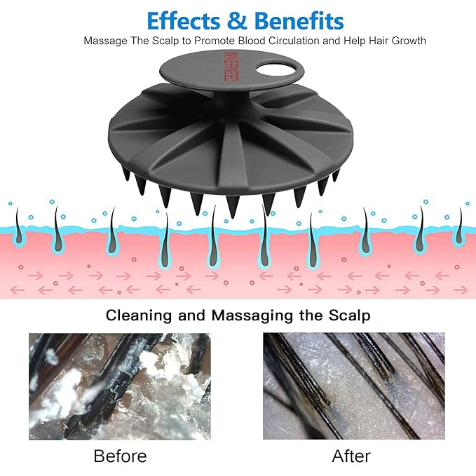 INNERNEED Scalp Massager Shampoo Brush, Wet & Dry Manual Scalp Care Head Scrubber Hair Washing, Soft Silicone Bristles, for Hair Growth, Dandruff Removal (Pack of 4)-Velvo Beauty