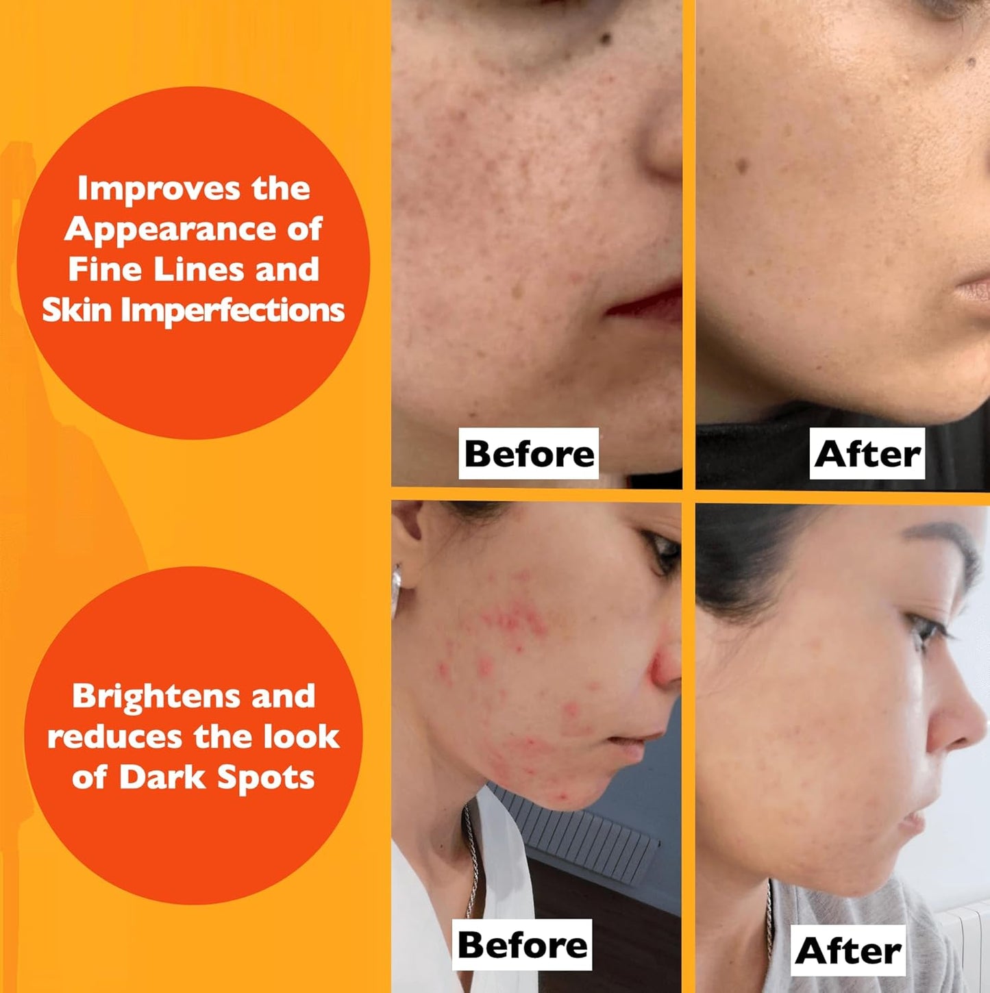 Vitamin C Serum For Face – Anti-Aging Facial Serum with Vitamin C, Hyaluronic Acid, Niacinamide, B5 & Vit E. Brightening Facial Essence for Dark Spots, Fine Lines, Wrinkles & Glowing Skin, 2 Fl Oz-Velvo Beauty