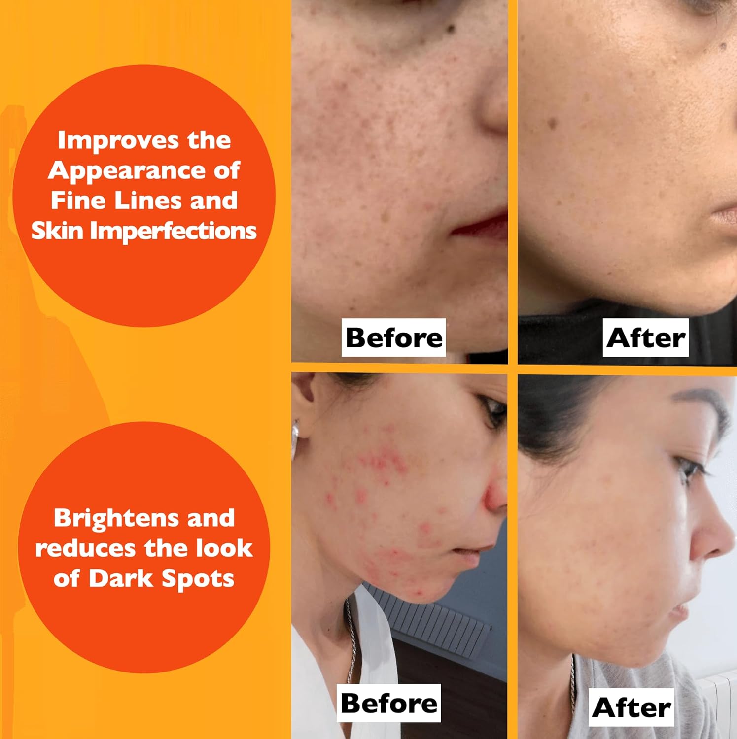 Vitamin C Serum For Face – Anti-Aging Facial Serum with Vitamin C, Hyaluronic Acid, Niacinamide, B5 & Vit E. Brightening Facial Essence for Dark Spots, Fine Lines, Wrinkles & Glowing Skin, 2 Fl Oz-Velvo Beauty