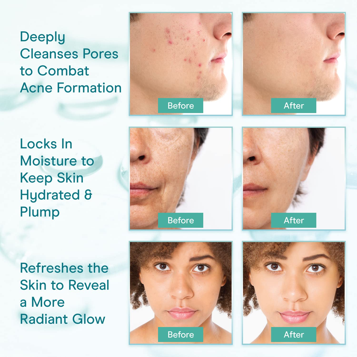 Baebody Cleansing Milk for Face - Vegan Facial Cleanser for Women and Men - Micellar Makeup Remover - Milk Cleanser Face Wash (8 fl oz)-Velvo Beauty