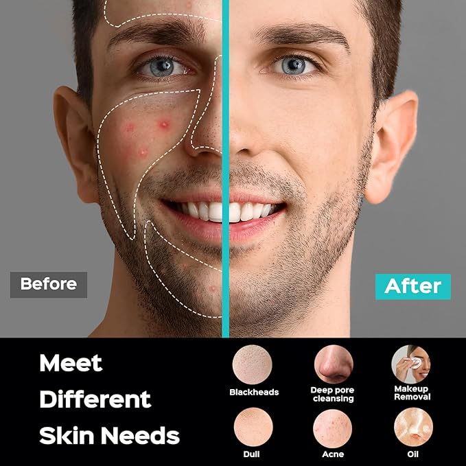 COSLUS Facial Cleansing Brush Face Scrubber : Portable Silicone Waterproof Rechargeable Face Wash Brush, 5 Cleansing Modes, Electric Deep Cleaning for Men & Women, Removing Blackhead, Exfoliating-Velvo Beauty