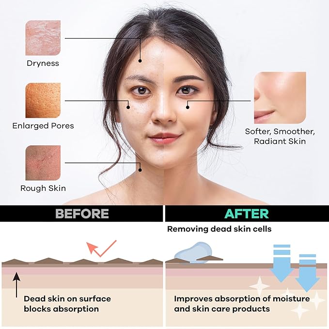 Dermasuri Deep Exfoliating Face Mitt - Scrubber, Dead and Dry Skin Remover for Men and Women - Exfoliator Gloves for Shower and Dry Use - (2 Pack)-Velvo Beauty