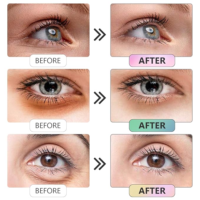 Under Eye Patches -30 Pairs Sakura Essence Eye Mask for Puffy Eyes,Reducing Dark Circles,Anti-Aging & Refreshing, Collagen Eye Mask for Moisturizing,Sakura Pink-Velvo Beauty