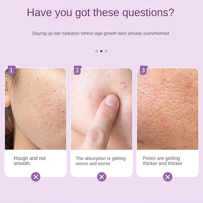 Ice Roller for Face Women - 2 in 1 Facial Ice Roller for Face & Eye Puffiness Relief, Gua Sha Facial Tools for Massage, Body Minor Cold Compress-Velvo Beauty