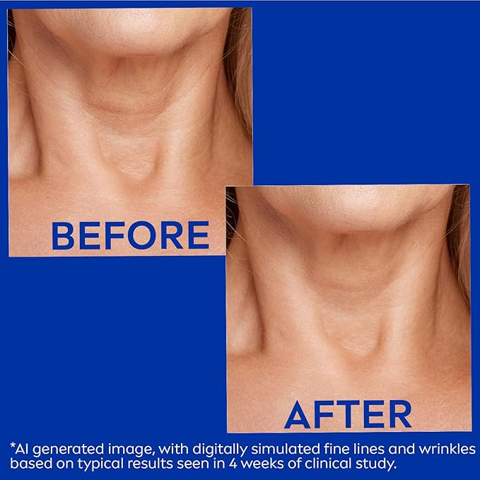 NIVEA Skin Firming & Anti Wrinkle Neck & Chest Cream with Coenzyme Q10, Creatine and Provitamin B5, Skin Firming Cream Reduces the Look of Fine Lines and Wrinkles, 6.7 Oz Tube-Velvo Beauty