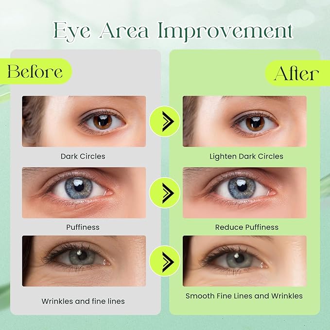 60 Pack Avocado Extract Eye Masks,Hyaluronic Acid Augenpads,Moisturising Eye Mask,Remove Dark Circles,Tear Bags,Wrinkles,Puffiness,Suitable for All Skin Types-Velvo Beauty