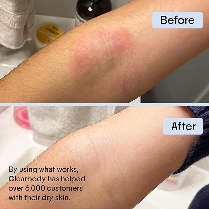 Clearbody Organics Colloidal Oatmeal Eczema Cream with Manuka Honey - 4 oz - Plant-Based Moisturizer & Eczema Ointment for Dry, Itchy Skin Relief-Velvo Beauty