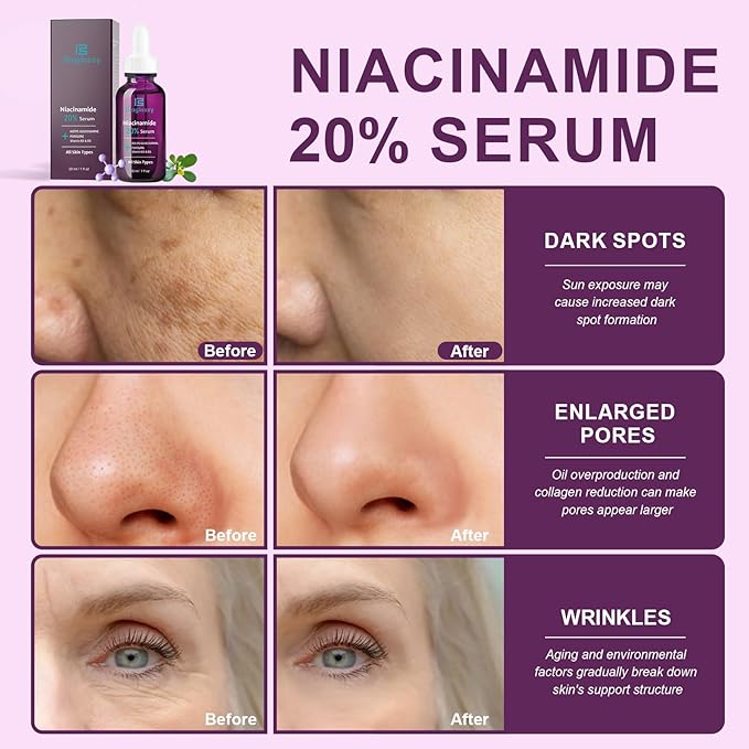 20% Niacinamide Serum for Face,Niacinamide Vitamin B3 B5 Concentrated Serum,Moisturizer,Pore Minimizer,Anti-aging Discoloration Correcting Treatment-Velvo Beauty