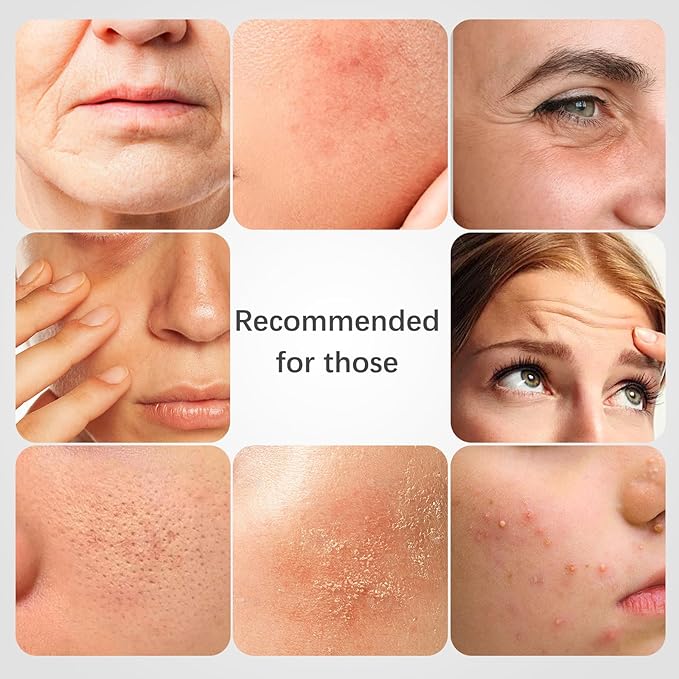 ISTON 4-in-1 Bio-Collagen Real Deep Mask Set -Plump Sagging Skin,Deep Hydration,Soothe & Repair,Nourish & Firm, Overnight Hydrogel Mask for All Skin Type-Velvo Beauty