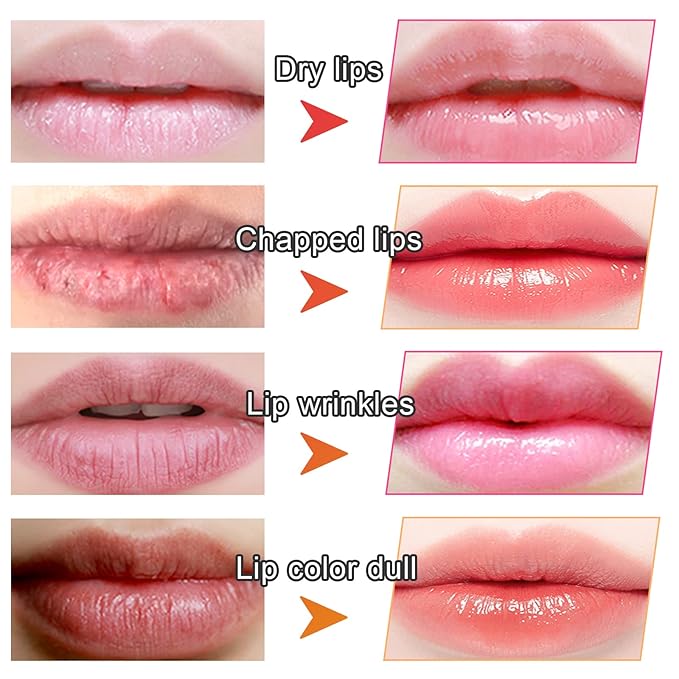 Adofect 30 Pieces Collagen Crystal Lip Masks, Collagen Lip Pads Great for Moisturizing, Remove Dead Skin, Anti Chapped & Anti-Aging and Plump Your Lips, Watermelom Red-Velvo Beauty