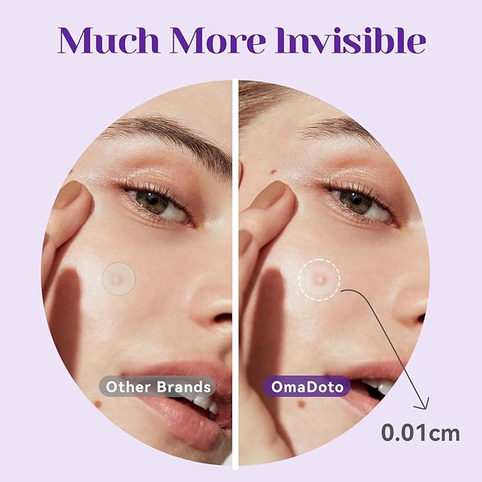 Overnight Pimple Patches for Face - Maximum Strength Hydrocolloid for Cystic Acne & Dark Spots (72 Count) - 10mm & 12mm Medicated Night Time Treatment-Velvo Beauty